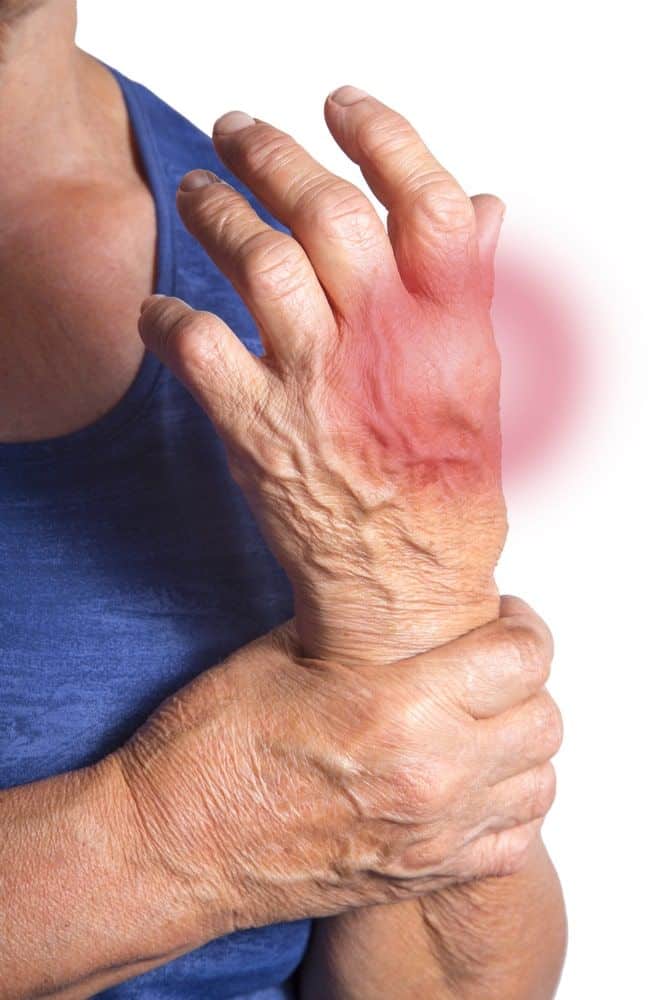 Arthritis is a common cause of joint pain.