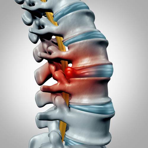 A well-aligned spine is needed to avoid pinched nerves.